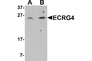 Western blot analysis of ECRG4 in HeLa cell lysate with ECRG4 antibody at (A) 1 and (B) 2 µg/mL. (C2orf40 anticorps  (C-Term))
