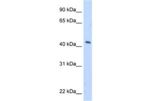 Western Blotting (WB) image for anti-Melanoma Antigen Family A, 1 (Directs Expression of Antigen MZ2-E) (MAGEA1) antibody (ABIN2462943) (MAGEA1 anticorps)