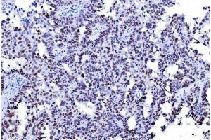 IHC analysis of MSH2 using anti-MSH2 antibody (ABIN7601369).