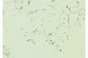 ABIN6276695 at 1/100 staining Human lung tissue by IHC-P. (Adiponectin Receptor 1 anticorps  (C-Term))
