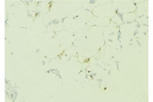 ABIN6276695 at 1/100 staining Human lung tissue by IHC-P.