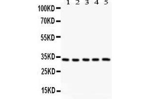 Anti-HSD11B1  antibody, Western blottingAll lanes: All lanes: Anti HSD11B1  at 0. (HSD11B1 anticorps  (N-Term))