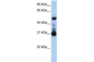 WB Suggested Anti-ACVRL1 Antibody Titration:  0. (ACVRL1 anticorps  (N-Term))
