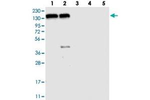 Western blot analysis of Lane 1: RT-4, Lane 2: U-251 MG, Lane 3: Human Plasma, Lane 4: Liver, Lane 5: Tonsil with FAM120A polyclonal antibody  at 1:250-1:500 dilution. (FAM120A anticorps)