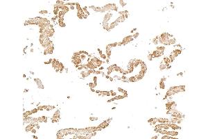 Immunocytochemistry (ICC) image for anti-Nuclear Factor-kB p65 (NFkBP65) (C-Term) antibody (ABIN7795800)
