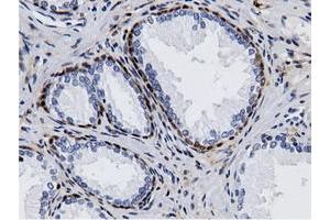 Immunohistochemical staining of paraffin-embedded Human liver tissue using anti-AK5 mouse monoclonal antibody. (Adenylate Kinase 5 anticorps)