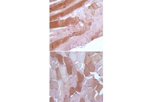Immunohistochemical analysis of paraffin-embedded human skeletal muscle tissue, showing nuclear and cytoplasmic localization using MB monoclonal antibody, clone 6H8B5, 5A2G8, 4D7H3, 3H6A7  with DAB staining.