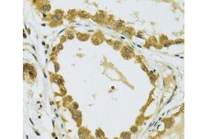 Immunohistochemistry of paraffin-embedded Human breast using RPS7 Polyclonal Antibody at dilution of 1:100 (40x lens). (RPS7 anticorps)