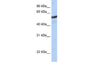 WB Suggested Anti-ME3 Antibody Titration:  0. (ME3 anticorps  (N-Term))