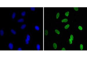 Immunofluorescence staining of HeLa cells using CBX1 monoclonal antibody, clone 5A3 (Green). (CBX1 anticorps)