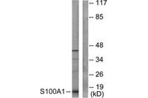 Western blot analysis of extracts from A549 cells, using S100 A1 Antibody.