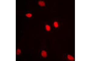 Immunofluorescent analysis of ADAR2 staining in MCF7 cells. (RED1 anticorps  (Center))
