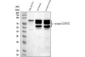 Western blot analysis of Synapsin II using anti-Synapsin II antibody (ABIN4886735).