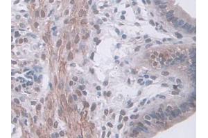 IHC-P analysis of Mouse Uterus Tissue, with DAB staining. (HSF4 anticorps  (AA 159-411))