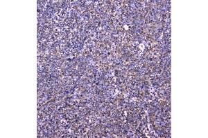 IHC analysis of cortactin using anti-cortactin antibody (ABIN6719306). (Cortactin anticorps  (AA 1-105))