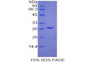SDS-PAGE analysis of Rat TMEM173 Protein. (STING/TMEM173 Protéine)