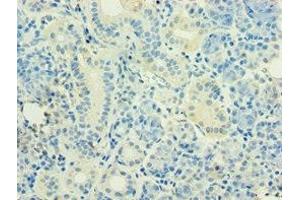 Immunohistochemistry of paraffin-embedded human pancreatic tissue using ABIN7155743 at dilution of 1:100 (HOXB5 anticorps  (AA 1-170))