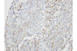 IHC-P Image Immunohistochemical analysis of paraffin-embedded H3347 xenograft, using PRKX, antibody at 1:500 dilution.