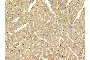 ABIN7097149 and ABIN7101217 at 1/100 staining rat heart tissue by IHC-P. (ACMSD anticorps)