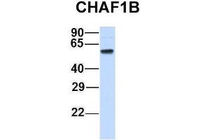 Host:  Rabbit  Target Name:  CHAF1B  Sample Type:  Human Adult Placenta  Antibody Dilution:  1. (CHAF1B anticorps  (N-Term))