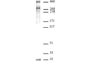 SMRT / NCoR2 antibody (pAb) tested by Western blot. (NCOR2 anticorps  (N-Term))