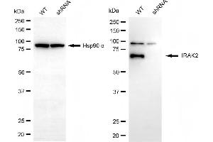 anti-Interleukin-1 Receptor-Associated Kinase 2 (IRAK2) antibody