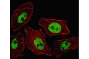 Fluorescent image of U251 cell stained with PHOX2B antibody. (PHOX2B anticorps  (AA 104-130))