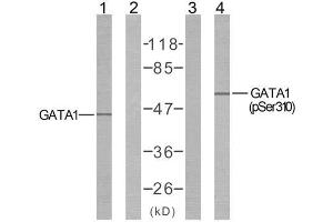 Western blot analysis of extract from COS7 cells untreated or treated with EPO using GATA1 (Ab-310) antibody (E021042, Line 1 and 2) and GATA1 (phospho-Ser310) antibody (E011042, Line 3 and 4). (GATA1 anticorps  (pSer310))