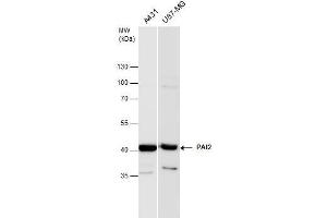 WB Image PAI2 antibody detects PAI2 protein by western blot analysis. (SERPINB2 anticorps  (Center))