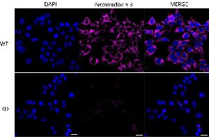 Immunocytochemical staining of Hela cells using Peroxiredoxin 3 antibody (ABIN7799778), 1:1,000), Top panel: wild-type (WT), Bottom panal: Peroxiredoxin 3 shRNA knockdown (KD). (Recombinant Peroxiredoxin 3 anticorps)