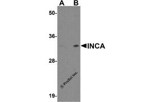 Western Blotting (WB) image for anti-Family with Sequence Similarity 212, Member A (FAM212A) (C-Term) antibody (ABIN1030439)