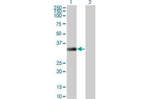Western Blot analysis of ITPK1 expression in transfected 293T cell line by ITPK1 monoclonal antibody (M01), clone 2C8. (ITPK1 anticorps  (AA 1-314))