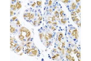 Immunohistochemistry of paraffin-embedded Human stomach using FECH Polyclonal Antibody at dilution of 1:100 (40x lens). (FECH anticorps)
