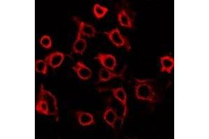 Immunofluorescent analysis of EP2 staining in HuvEc cells. (PTGER2 anticorps  (C-Term))