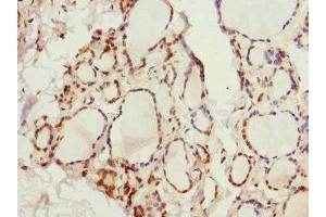 Immunohistochemistry of paraffin-embedded human thyroid tissue using ABIN7163952 at dilution of 1:100 (KCNA3 anticorps  (AA 486-575))