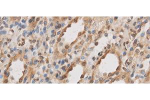 Immunohistochemistry of paraffin-embedded Rat kidney using IL10RB Polyclonal Antibody at dilution of 1:50 (IL10RB anticorps)