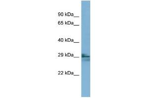 WB Suggested Anti-LIM2 Antibody Titration:  0. (LIM2 anticorps  (N-Term))