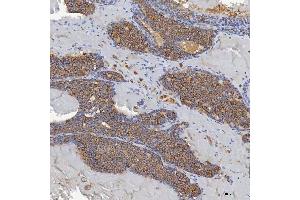 IHC analysis of ACAD9 using anti-ACAD9 antibody (ABIN7602670).