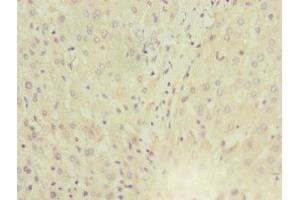 Immunohistochemistry of paraffin-embedded human liver tissue using ABIN7143763 at dilution of 1:100