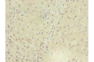 Immunohistochemistry of paraffin-embedded human liver tissue using ABIN7143763 at dilution of 1:100 (MGAT1 anticorps  (AA 156-445))