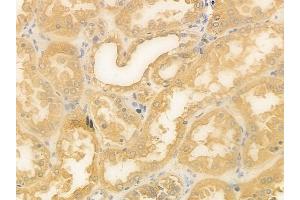 anti-Ras Association (RalGDS/AF-6) Domain Family Member 2 (RASSF2) (Internal Region) antibody