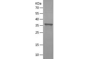 Western Blotting (WB) image for Glycosylphosphatidylinositol Specific phospholipase D1 (GPLD1) (AA 24-160) protein (His-IF2DI Tag) (ABIN7123170) (GPLD1 Protein (AA 24-160) (His-IF2DI Tag))