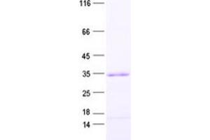 Validation with Western Blot