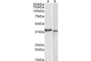 ABIN5539502 (2µg/ml) staining of Kelly (A) and U251-MG (B) lysates (35µg protein in RIPA buffer).