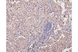 IHC analysis of COX IV using anti-COX IV antibody (ABIN7602090).