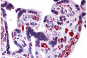 Human Placenta: Formalin-Fixed, Paraffin-Embedded (FFPE)