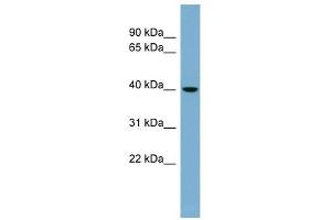 VPS37C antibody used at 1 ug/ml to detect target protein. (VPS37C anticorps)
