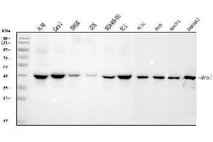 Western blot analysis of RRS1 using anti-RRS1 antibody (ABIN7601344).