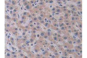 Detection of CTSV in Human Liver Tissue using Polyclonal Antibody to Cathepsin V (CTSV) (Cathepsin L2 anticorps  (AA 64-334))