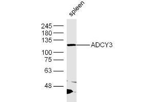 Mouse spleen lysates probed with ADCY3 Polyclonal Antibody, Unconjugated  at 1:300 dilution and 4˚C overnight incubation.